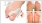 valgomed hallux valgus toe spreader product operation